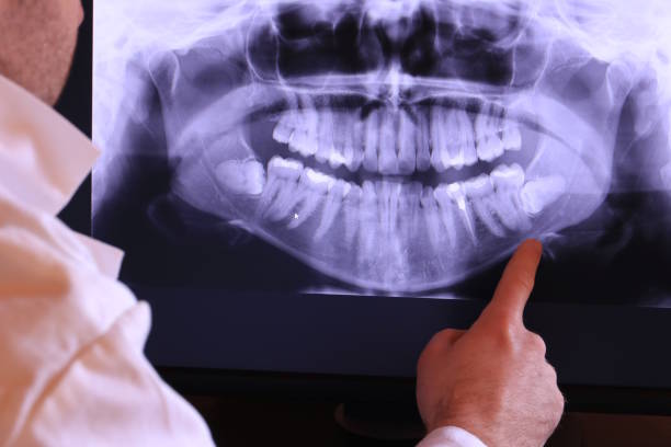 Best Emergency Dental Care for Broken or Chipped Teeth in , VA