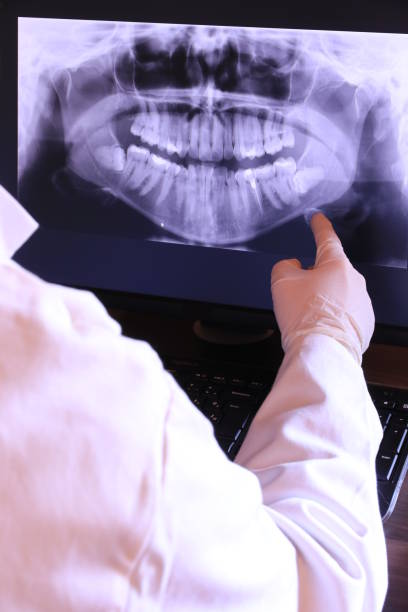 Best Emergency Tooth Extraction in , VA