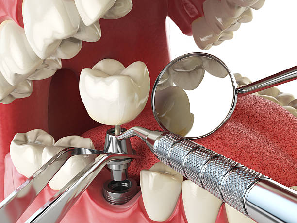 Best Emergency Treatment for Dental Infections or Abscesses in , VA