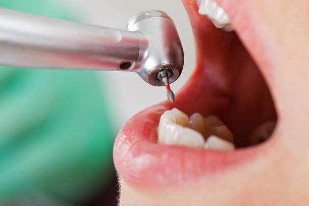 Best Emergency Gum Treatment in , VA